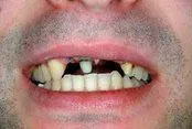 Before