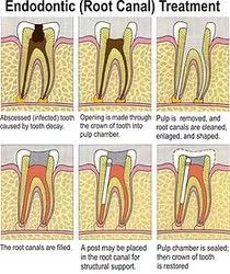 Dayboro Dental Centre